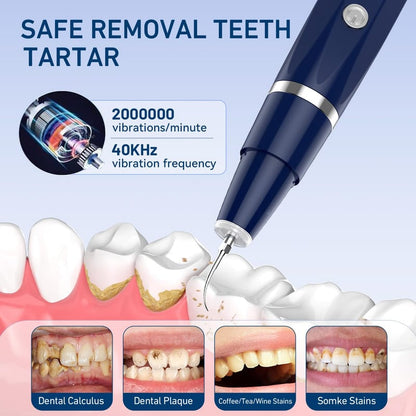 REMOVEDOR DE SARRO DE PLACA DENTAL