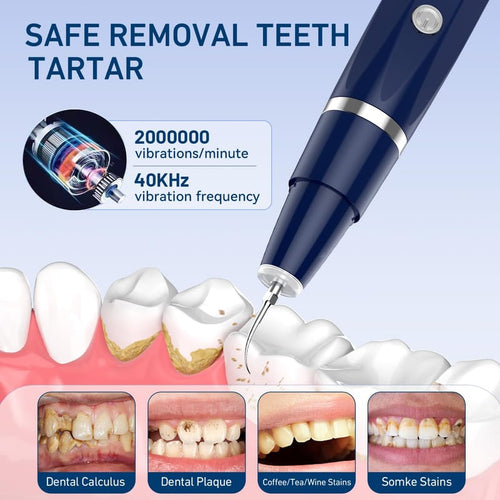 REMOVEDOR DE SARRO DE PLACA DENTAL