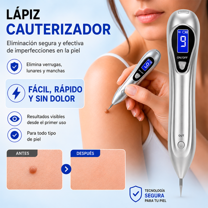 Cauterizador de Verrugas